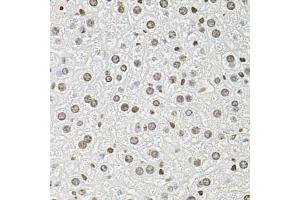 Immunohistochemistry of paraffin-embedded mouse liver using FOSL1 antibody. (FOSL1 antibody)
