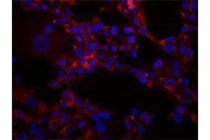 Immunofluorescence (IF) image for anti-Intercellular Adhesion Molecule 1 (ICAM1) antibody (ABIN2664765) (ICAM1 antibody)