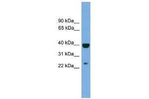 SOCS1 antibody used at 1 ug/ml to detect target protein. (SOCS1 antibody  (Middle Region))