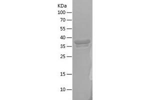 Western Blotting (WB) image for Cereblon (CRBN) (AA 1-80) protein (His-IF2DI Tag) (ABIN7282230) (CRBN Protein (AA 1-80) (His-IF2DI Tag))