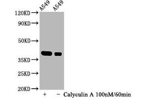 Western Blotting (WB) image for anti-Nuclear Factor of kappa Light Polypeptide Gene Enhancer in B-Cells Inhibitor, alpha (NFKBIA) (pSer32) antibody (ABIN7127721)
