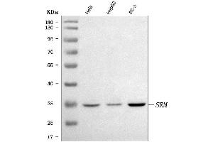 Western blot analysis of Spermidine synthase/SRM using anti-Spermidine synthase/SRM antibody (ABIN7600105).
