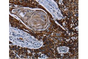 Immunohistochemistry (IHC) image for anti-Carnitine Palmitoyltransferase 2 (CPT2) antibody (ABIN3023424) (CPT2 antibody)