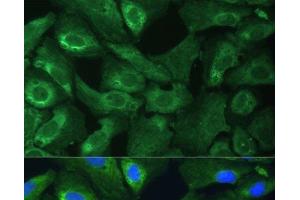 Immunofluorescence analysis of U-2 OS cells using EIF3G Polyclonal Antibody at dilution of 1:100 (40x lens). (EIF3G antibody)