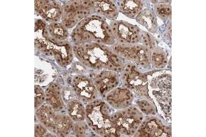Immunohistochemical staining of human kidney with WDR44 polyclonal antibody  shows nuclear, cytoplasmic and membranous positivity in cells of tubules. (WDR44 antibody)