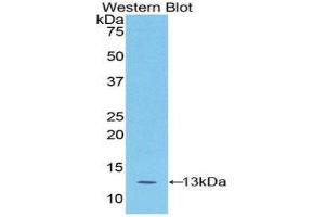 Western Blotting (WB) image for anti-S100 Calcium Binding Protein A4 (S100A4) (AA 1-101) antibody (ABIN1078504)