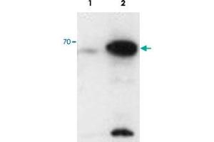 AIRE polyclonal antibody  staining (0. (AIRE antibody)