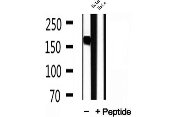 PPFIA1 Antikörper  (C-Term)