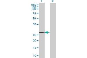 Western Blot analysis of FKBP3 expression in transfected 293T cell line by FKBP3 MaxPab polyclonal antibody. (FKBP3 antibody  (AA 1-224))