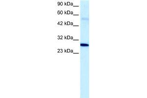 WB Suggested Anti-PAntibody Titration:  5. (PARP1 antibody  (C-Term))