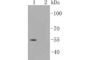 Lane 1: A431 cell lysates-untreated, Lane 2: A431 cell lysates-treated with TGF beta, probed with Smad3(S423/S425) (5C5 ) Monoclonal Antibody  at 1:1000 overnight at 4˚C. (SMAD3 antibody  (pSer423, pSer425))