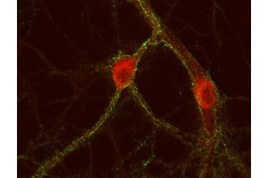 Indirect immunostaining of PFA fixed rat hippocampus neurons with anti-cytohesin 3 (dilution 1 : 500; red) and mouse anti-synapsin 1 (cat. (Cytohesin 3 antibody)