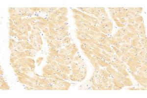 Detection of MHCE in Human Heart Tissue using Polyclonal Antibody to Major Histocompatibility Complex Class I E (MHCE) (HLA-E antibody  (AA 22-358))