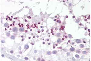Anti-DYRK2 antibody IHC staining of human testis.