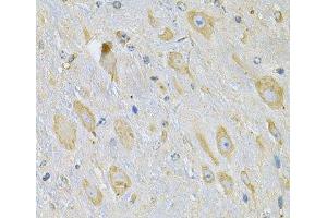 Immunohistochemistry of paraffin-embedded Mouse brain using TXNDC5 Polyclonal Antibody at dilution of 1:100 (40x lens).