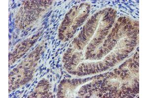 Immunohistochemistry (IHC) image for anti-Myeloid Leukemia Factor 2 (MLF2) antibody (ABIN1499502) (MLF2 antibody)