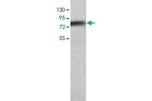 Western blot analysis of human liver tissue lysate with ANGPTL1 polyclonal antibody  at 1:200 dilution. (ANGPTL1 antibody)