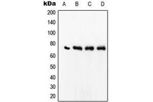 Western blot analysis of SRF expression in Jurkat (A), MCF7 (B), HeLa (C), Raw264. (SRF antibody  (Center))