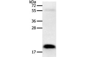 Western Blot analysis of Human colon cancer tissue using PTN Polyclonal Antibody at dilution of 1:600 (Pleiotrophin antibody)