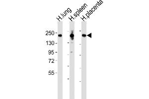 All lanes : Anti-MRC1L1 Antibody (N-term) at 1:2000 dilution Lane 1: human lung lysates Lane 2: human spleen lysates Lane 3: human placenta lysates Lysates/proteins at 20 μg per lane. (Macrophage Mannose Receptor 1 antibody  (N-Term))