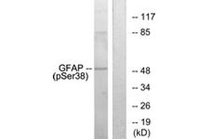 Western blot analysis of extracts from HeLa cells, using GFAP (Phospho-Ser38) Antibody. (GFAP antibody  (pSer38))