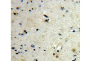Used in DAB staining on fromalin fixed paraffin-embedded Brain tissue (CGB antibody  (AA 31-165))