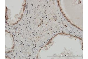 Immunoperoxidase of monoclonal antibody to ZNF202 on formalin-fixed paraffin-embedded human prostate. (ZNF202 antibody  (AA 301-400))