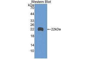 Western Blotting (WB) image for anti-Growth Arrest and DNA-Damage-Inducible, beta (GADD45B) (AA 1-160) antibody (ABIN2116595)