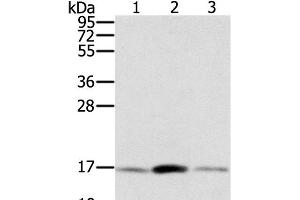 Western Blot analysis of Hela, hepg2 and PC3 cell using PPIA Polyclonal Antibody at dilution of 1:300 (PPIA antibody)