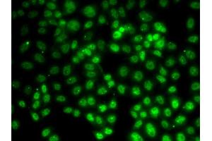 Immunofluorescence analysis of HeLa cells using PRMT2 antibody (ABIN6127447, ABIN6146227, ABIN6146228 and ABIN6221530).