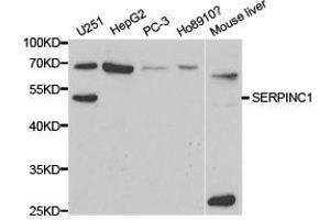 Western Blotting (WB) image for anti-Serpin Family C Member 1 (SERPINC1) antibody (ABIN1874738) (SERPINC1 antibody)