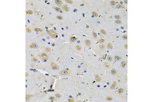 Immunohistochemistry of paraffin-embedded rat brain using RRAGC Antibody (ABIN5975563) at dilution of 1/100 (40x lens). (GTR2 antibody)