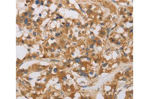 Immunohistochemistry (IHC) image for anti-RAD54-Like 2 (RAD54L2) antibody (ABIN2422109) (ARIP4 antibody)