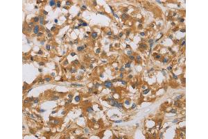 Immunohistochemistry (IHC) image for anti-RAD54-Like 2 (RAD54L2) antibody (ABIN2422108) (ARIP4 antibody)