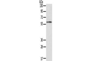 Gel: 8 % SDS-PAGE, Lysate: 40 μg, Lane: Human placenta tissue, Primary antibody: ABIN7191225(KLHL8 Antibody) at dilution 1/200, Secondary antibody: Goat anti rabbit IgG at 1/8000 dilution, Exposure time: 10 seconds (KLHL8 antibody)