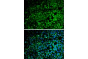 Immunofluorescence analysis of HeLa cells using TRIM13 antibody (ABIN5973665).