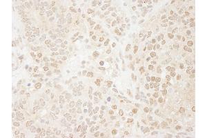 anti-Drosha, Ribonuclease Type III (DROSHA) (AA 1050-1100) antibody