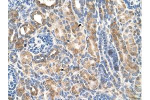 CDH3 antibody was used for immunohistochemistry at a concentration of 4-8 ug/ml to stain Epithelial cells of renal tubule (arrows) in Human Kidney. (P-Cadherin antibody)