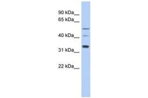TCP11 antibody  (AA 143-192)