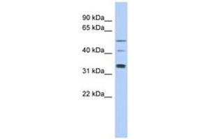 Image no. 1 for anti-T-Complex 11, Testis-Specific (TCP11) (AA 143-192) antibody (ABIN6743759) (TCP11 antibody  (AA 143-192))