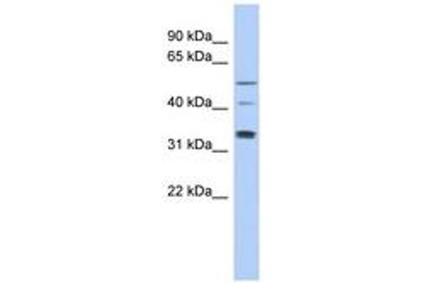 TCP11 anticorps  (AA 143-192)