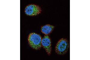 Immunofluorescence (IF) image for anti-HRas proto-oncogene, GTPase (HRAS) antibody (ABIN3003478) (HRAS antibody)