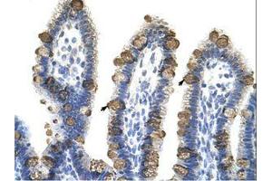 Image no. 1 for anti-Exosome Component 3 (EXOSC3) (AA 81-130) antibody (ABIN6736236) (EXOSC3 antibody  (AA 81-130))