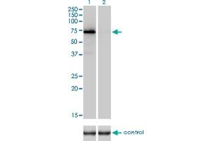 Western blot analysis of F2 over-expressed 293 cell line, cotransfected with F2 Validated Chimera RNAi (Lane 2) or non-transfected control (Lane 1). (Prothrombin antibody  (AA 263-362))