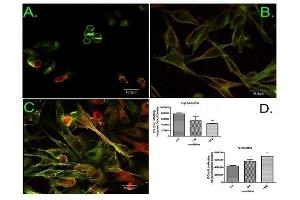 Image kindly submitted by Dr. (Fascin antibody  (pSer39))