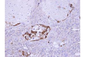 SOCS5 antibody  (N-Term)