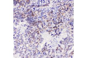 IHC analysis of Integrin alpha 3 using anti-Integrin alpha 3 antibody (ABIN6719410). (ITGA3 antibody)