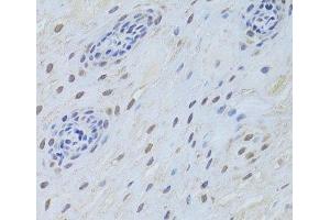 Immunohistochemistry of paraffin-embedded Human esophagus using TARDBP Polyclonal Antibody at dilution of 1:200 (40x lens). (TARDBP antibody)