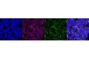 Immunohistochemistry (IHC) image for anti-Coiled-Coil Domain Containing 153 (CCDC153) antibody (ABIN7456187)