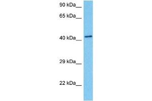Western Blotting (WB) image for anti-Poly(rC) Binding Protein 1 (PCBP1) (Middle Region) antibody (ABIN2778971)